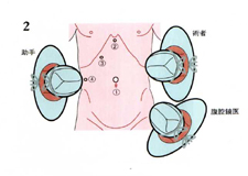 当院の手術方法