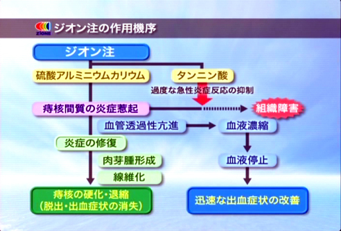 痔の疾患